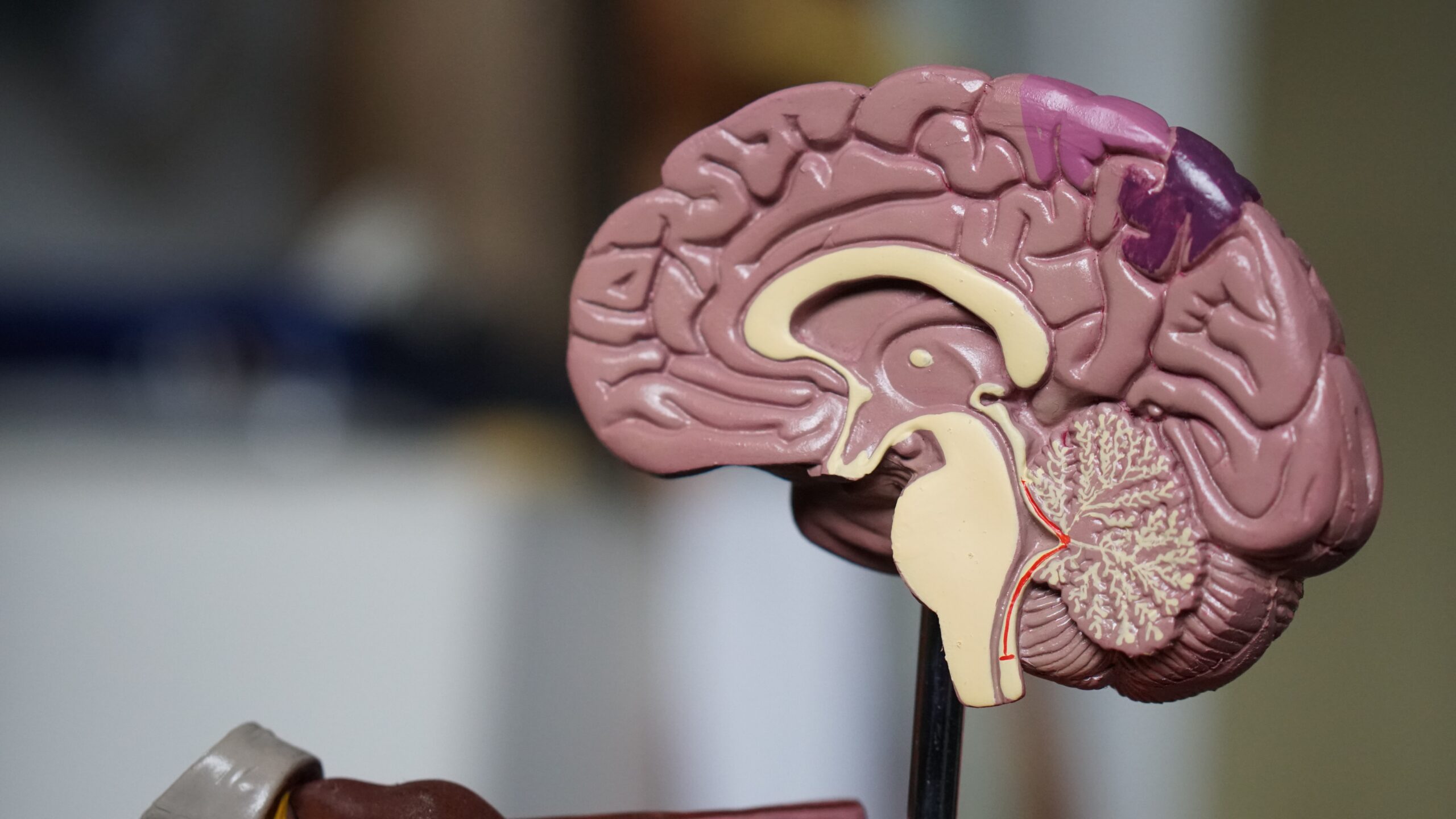What is Self Hypnosis?