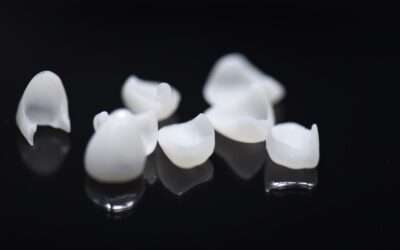How can veneers help improve my smile?