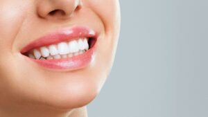 teeth whitening, white teeth, clean teeth